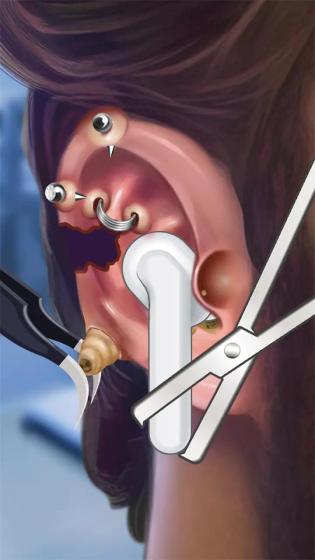 粉刺达人app免费游戏