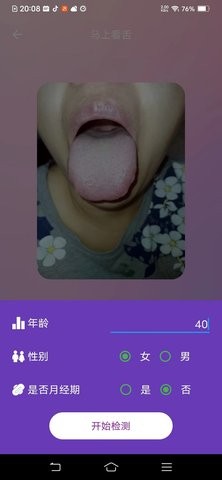 AI看舌APP