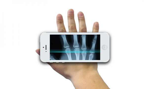 X光扫描仪安卓手机版3