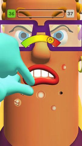 Pimple Popping游戏